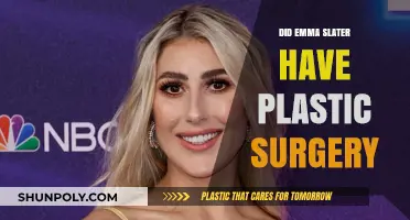 Emma Slater Plastic Surgery: Fact-Checking the Rumors and Speculations