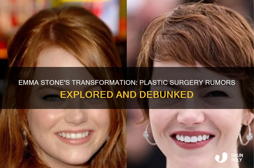 did emma stone had plastic surgery