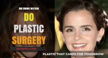 Emma Watson's Transformation: Plastic Surgery Rumors Explored and Debunked