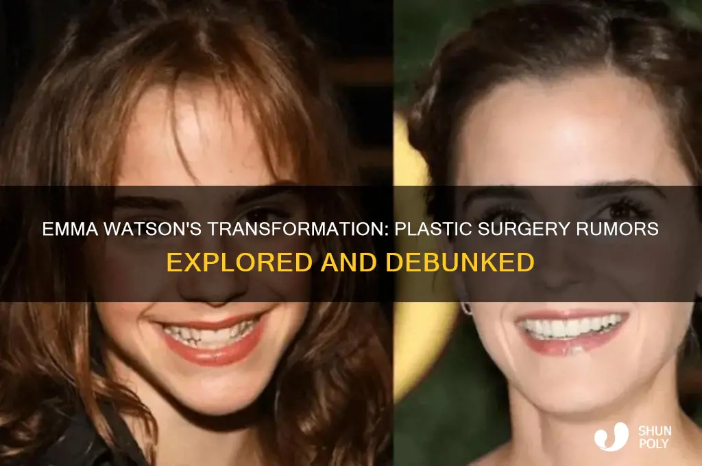 did emma watson do plastic surgery