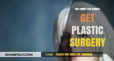 Emmy Lou Harris Plastic Surgery: Fact-Checking the Rumors and Speculations