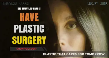 Emmylou Harris Plastic Surgery: Fact-Checking the Rumors and Speculations