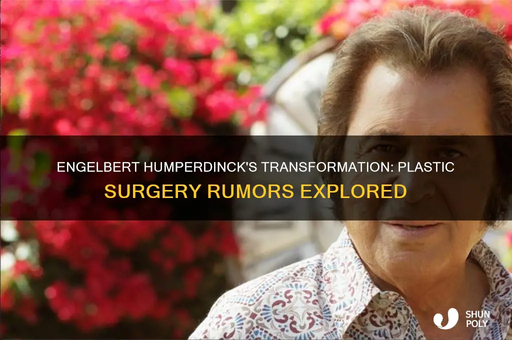 did engelbert humperdinck have plastic surgery