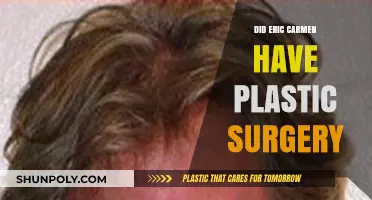 Eric Carmen's Transformation: Plastic Surgery Rumors Explored and Debunked
