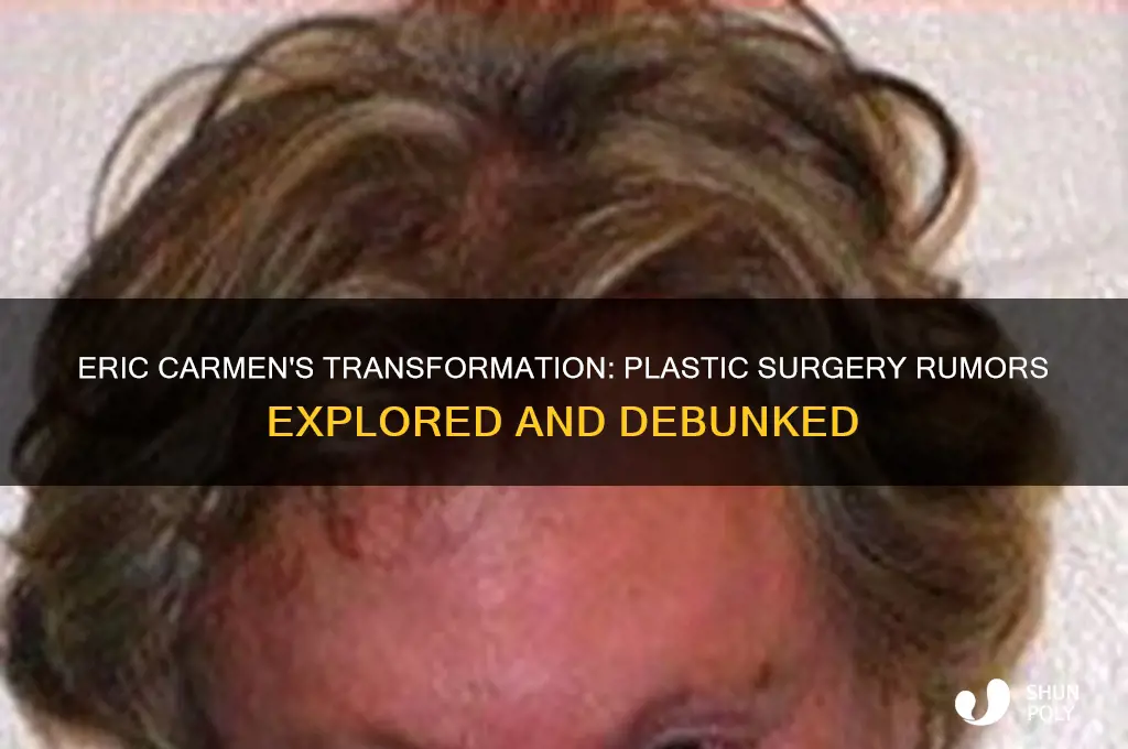 did eric carmen have plastic surgery