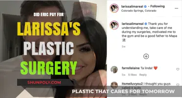 Eric's Role in Funding Larissa's Plastic Surgery: Fact or Fiction?
