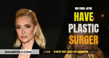 Erika Jayne's Plastic Surgery: Did She or Didn't She?