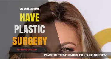 Erin Andrews Plastic Surgery: Fact-Checking the Rumors and Speculations