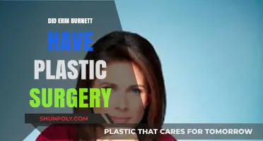 Erin Burnett Plastic Surgery: Fact-Checking Rumors and Speculations