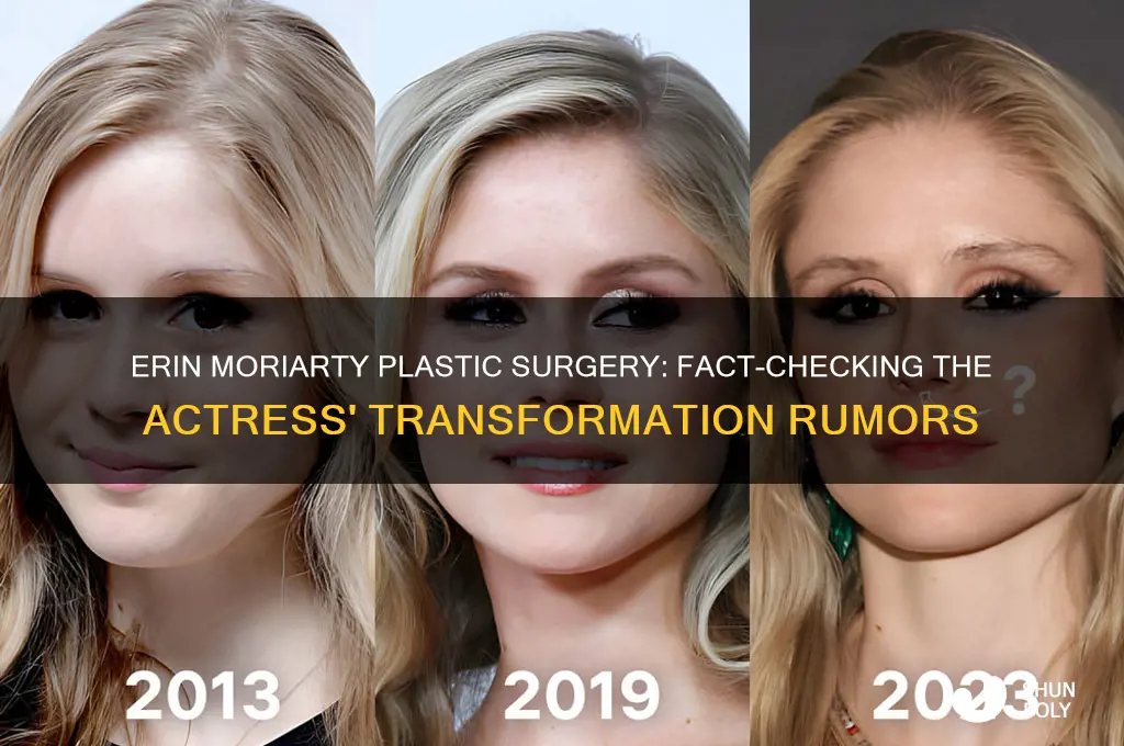 did erin moriarity get plastic surgery