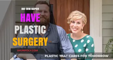 Erin Napier Plastic Surgery: Fact-Checking the Home Town Star's Look