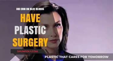 Erin Reagan's Transformation: Plastic Surgery Rumors on Blue Bloods