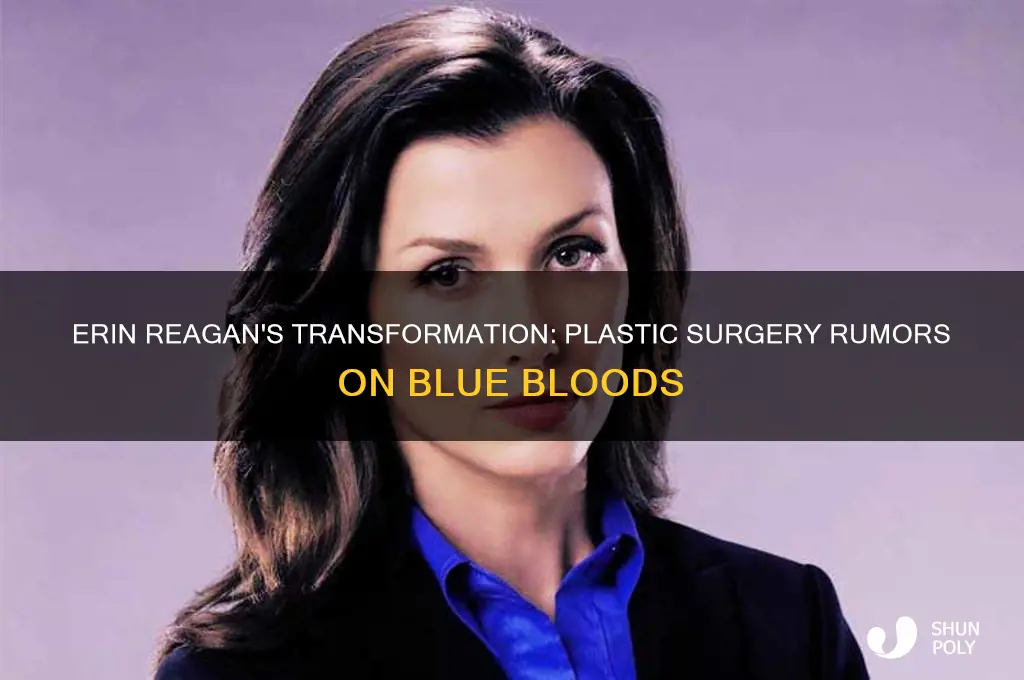 did erin on blue bloods have plastic surgery
