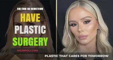 Erin from Hometown: Plastic Surgery Speculations and Transformation Truths