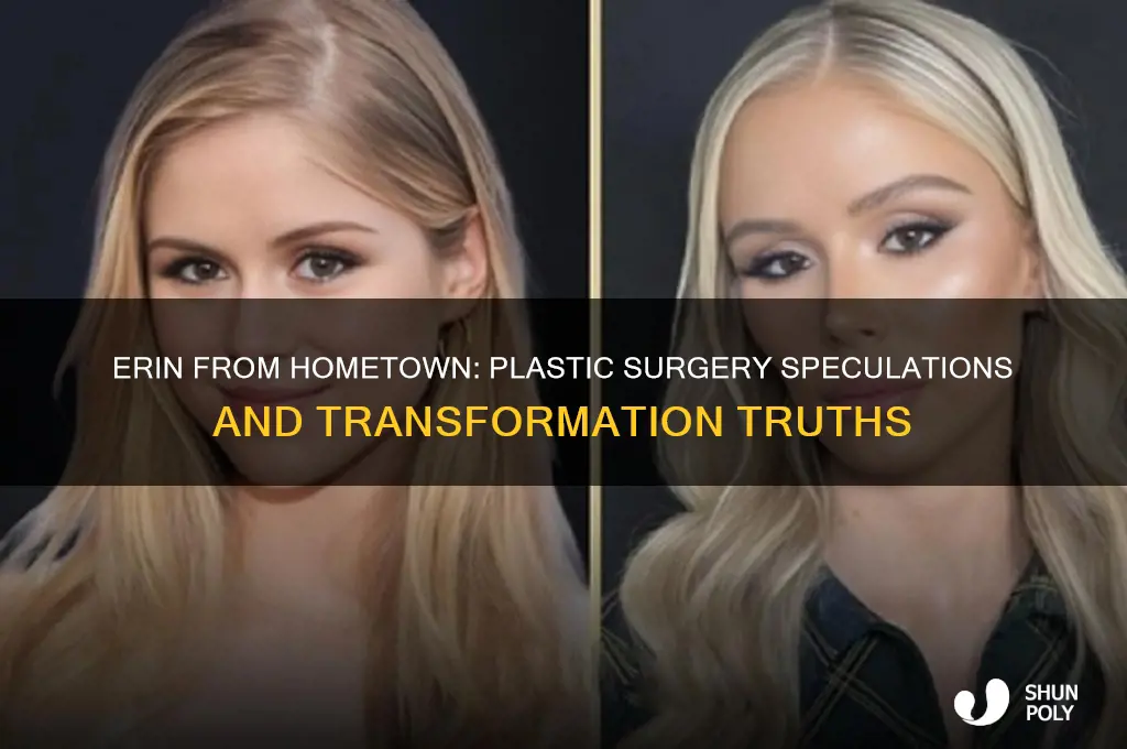 did erin on hometown have plastic surgery