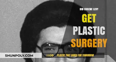 Eugene Levy's Transformation: Plastic Surgery Rumors Explored and Debunked