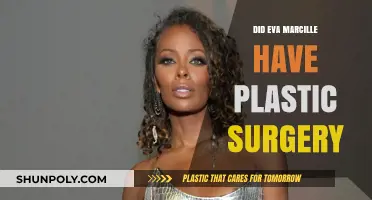 Eva Marcille's Transformation: Plastic Surgery Rumors Explored and Debunked