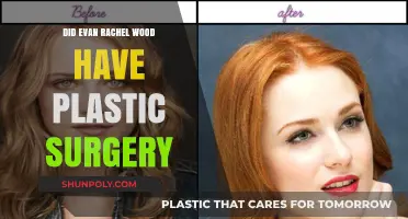 Evan Rachel Wood Plastic Surgery: Fact-Checking the Rumors and Speculations