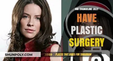 Evangeline Lilly Plastic Surgery: Fact-Checking the Rumors and Speculations