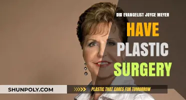 Joyce Meyer's Transformation: Plastic Surgery Speculations and Truths Revealed