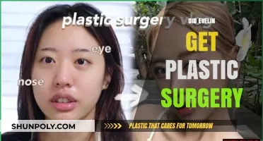 Evelin's Transformation: Plastic Surgery Speculations and Truths Revealed