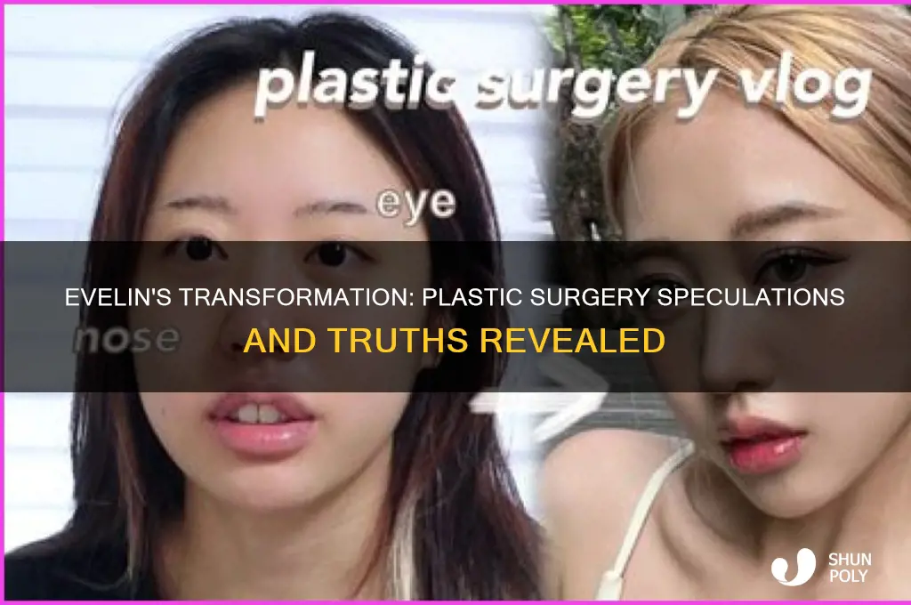 did evelin get plastic surgery