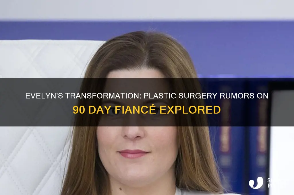 did evelyn from 90 day fiance get plastic surgery