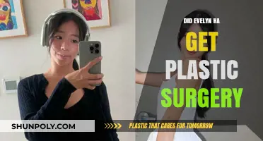 Evelyn Ha Plastic Surgery: Fact-Checking the Transformation Rumors