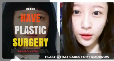 EXID Plastic Surgery Rumors: Fact-Checking the K-Pop Group's Transformation