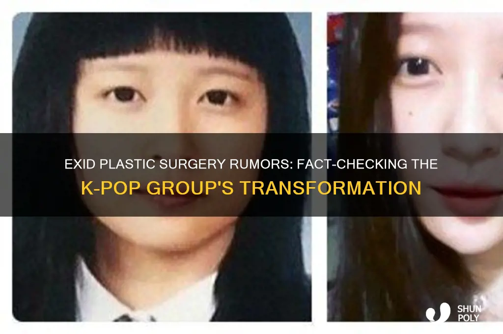did exid have plastic surgery