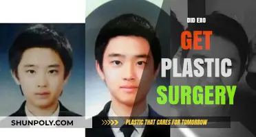 Did EXO Members Undergo Plastic Surgery? Unveiling the Truth