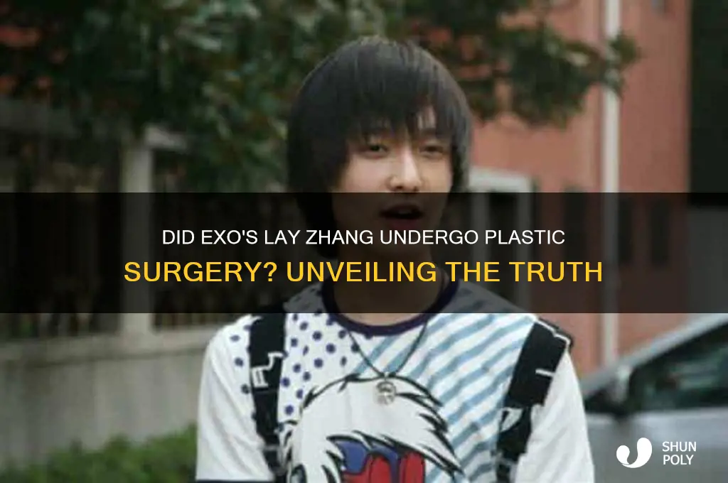 did exo lay get plastic surgery
