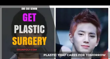 EXO Sehun Plastic Surgery: Fact-Checking the Rumors and Speculations
