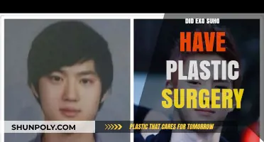 Unveiling the Truth: Did EXO's Suho Undergo Plastic Surgery?