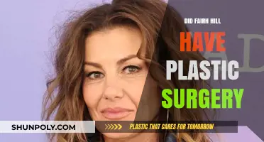 Faith Hill's Transformation: Plastic Surgery Rumors and Reality Explored