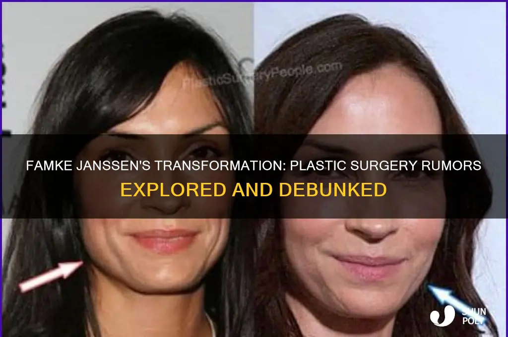 did famke have plastic surgery