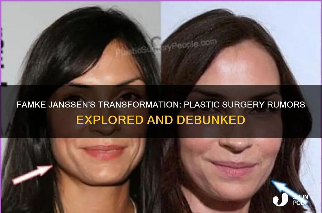 did famke jassen have plastic surgery