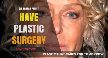 Farrah Fawcett's Transformation: Plastic Surgery Rumors and Reality Revealed