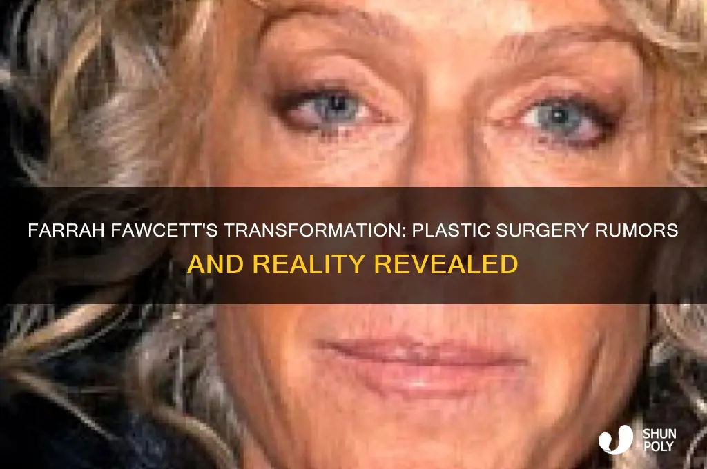 Farrah Fawcett's Transformation Plastic Surgery Rumors And Reality