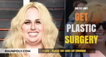 Fat Amy's Transformation: Plastic Surgery Rumors Explored and Debunked