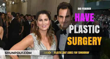Did Roger Federer Undergo Plastic Surgery? Unraveling the Truth