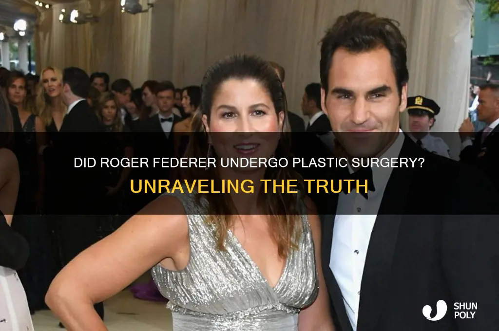 did federer have plastic surgery