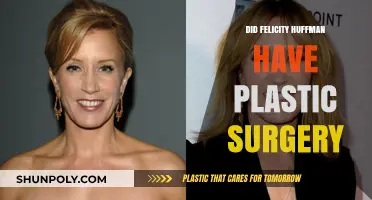 Felicity Huffman's Transformation: Plastic Surgery Rumors Explored
