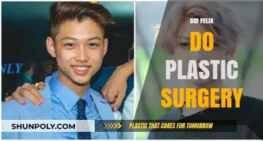 Did Felix Undergo Plastic Surgery? Uncovering the Truth Behind the Rumors