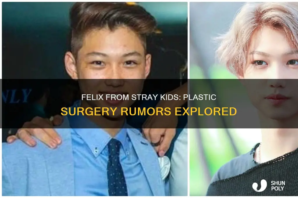 did felix from stray kids get plastic surgery
