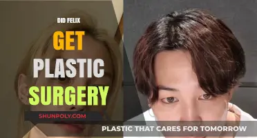 Did Felix Undergo Plastic Surgery? Uncovering the Truth Behind the Rumors