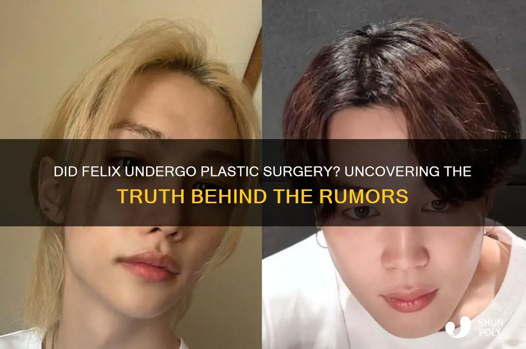 did felix get plastic surgery