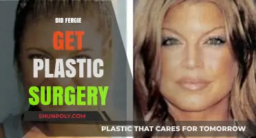 Fergie's Transformation: Plastic Surgery Rumors and the Truth Behind Her Look