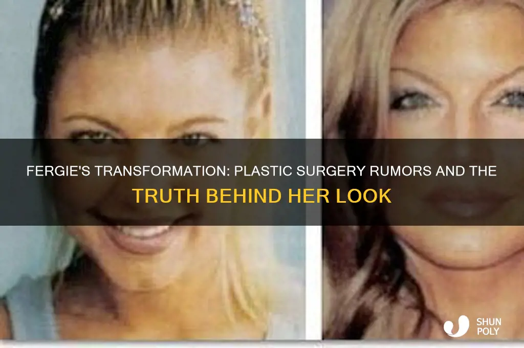 did fergie get plastic surgery
