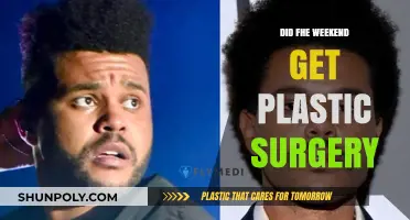 Did FHE Weekend Undergo Plastic Surgery? Uncovering the Truth